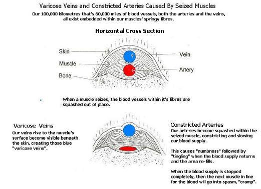 veins and arteries of body. Our Veins and Arteries Suffer